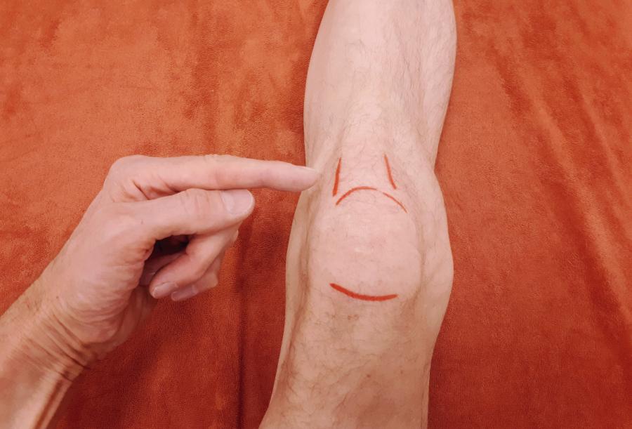Gesundheitstipp der Woche · Kniescheibensehne schmerzt – was tun bei Runner's Knee?