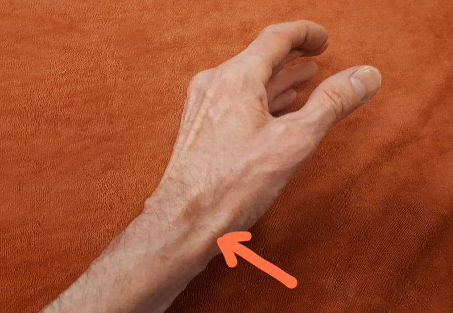Gesundheitstipp der Woche - Schmerzendes Handgelenk auf der Daumenseite – was ist das?